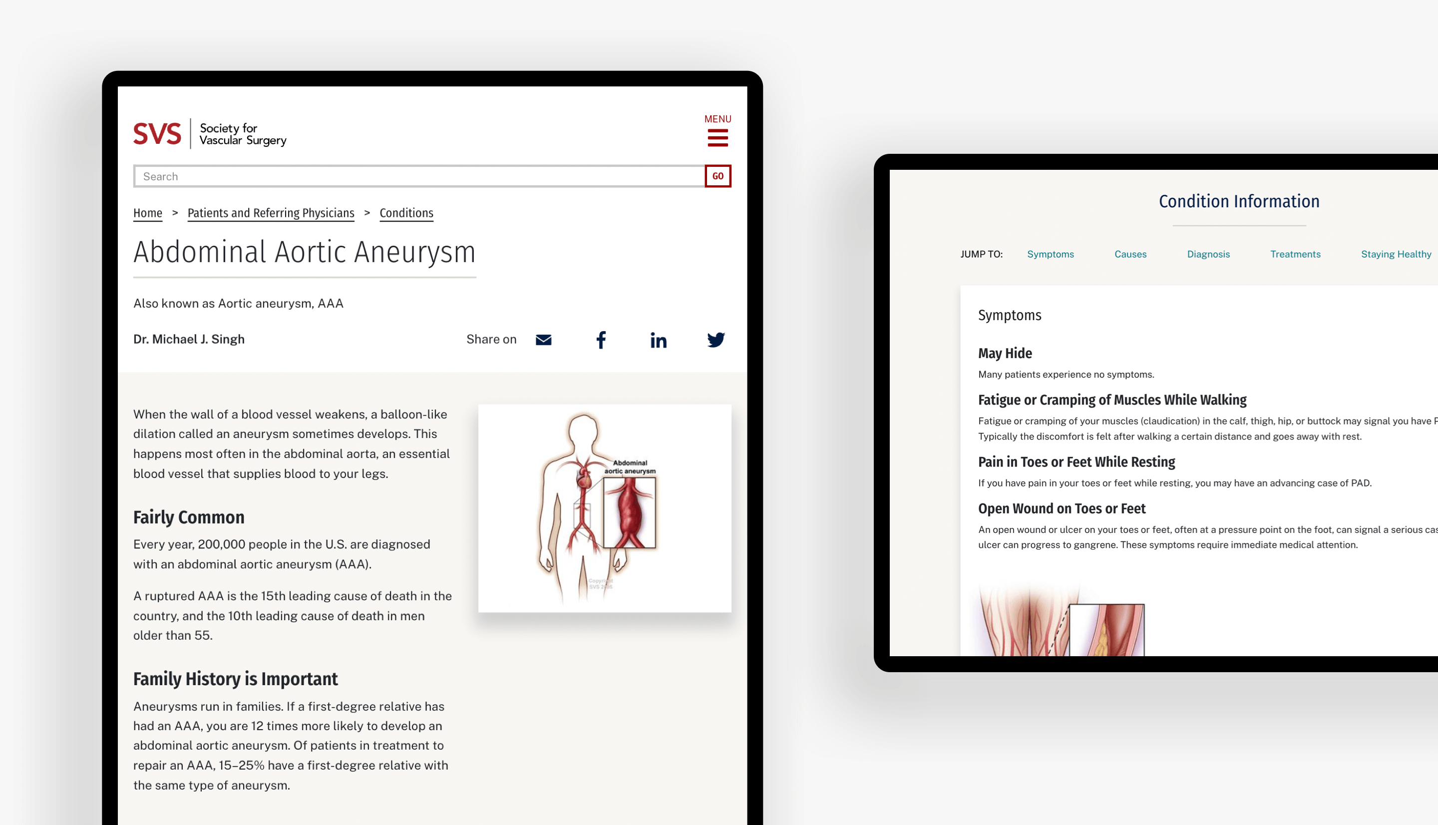 Two tablets with a patient condition page in view for Abdominal Aortic Aneurysm